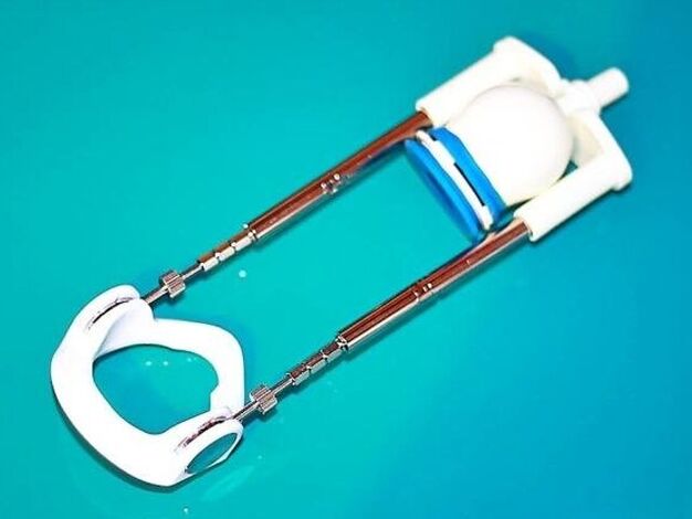 To lengthen the phallus, you can use a special device - an expander.